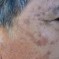 Nerium for Real Results