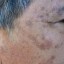 Nerium for Real Results